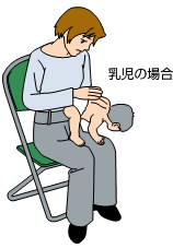乳児の場合の背部叩打法のイラスト